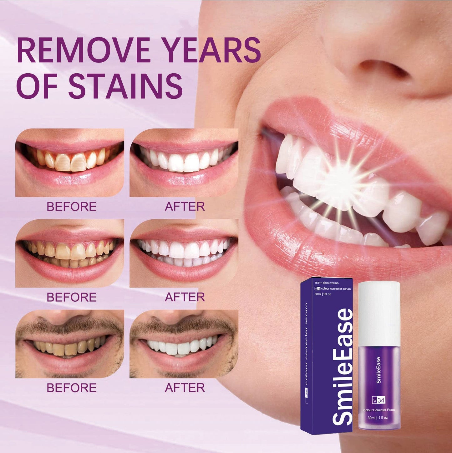Teeth Whitening Toothpaste